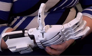 3D printed prosthetic hand 3D printed prosthetic hand
